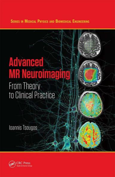 Advanced MR Neuroimaging