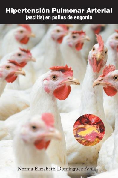 Hipertensión Pulmonar Arterial: (Ascitis) En Pollos De Engorda (Spanish Edition)