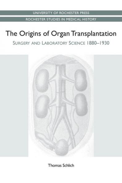 Origins of Organ Transplantation