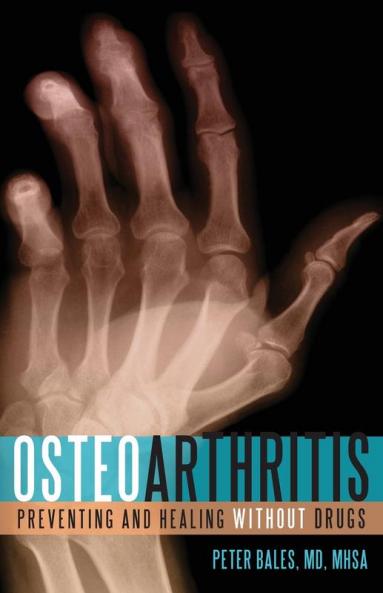 Osteoarthritis
