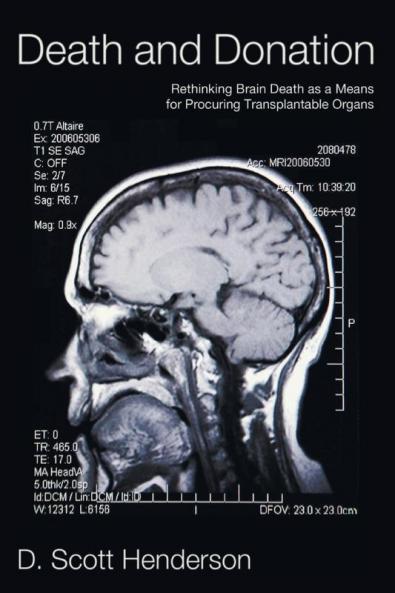 Death and Donation: Rethinking Brain Death as a Means for Procuring Transplantable Organs