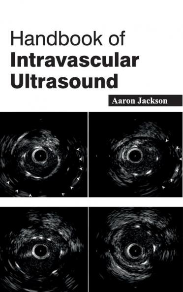Handbook of Intravascular Ultrasound