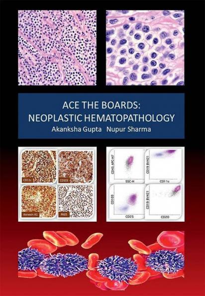 Ace The Boards: Neoplastic Hematopathology