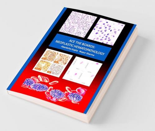 Ace The Boards: Neoplastic Hematopathology
