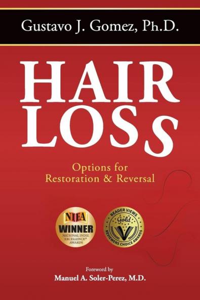 Hair Loss Second Edition
