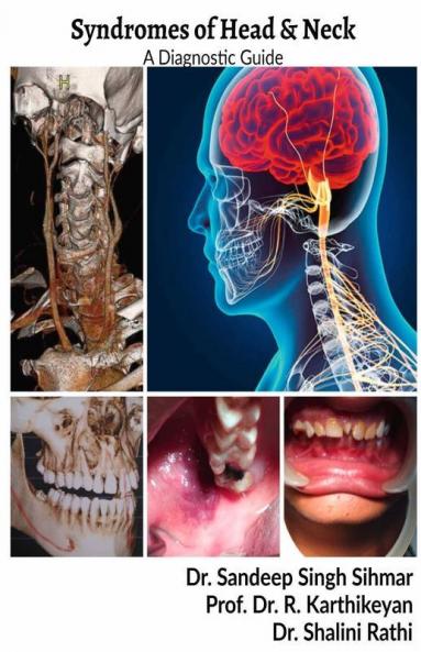 Syndromes Of Head And Neck : A Diagnostic Guide