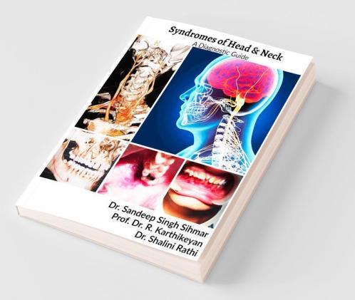 Syndromes Of Head And Neck : A Diagnostic Guide