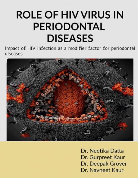 Role of HIV Virus in Periodontal Diseases : Impact of HIV infection as a modifier factor for periodontal diseases
