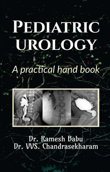Pediatric Urology : A Practical Hand Book