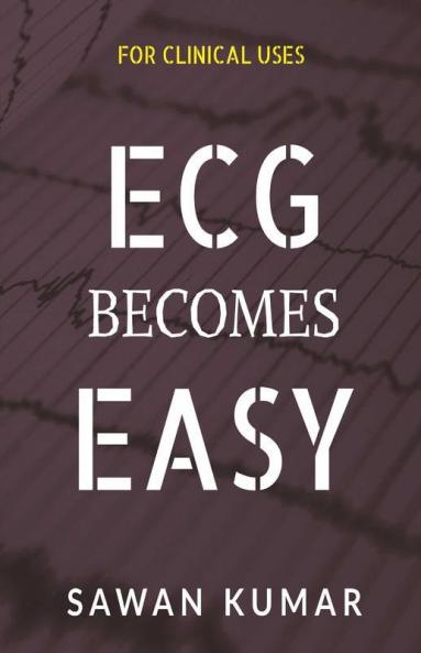 Ecg Becomes Easy