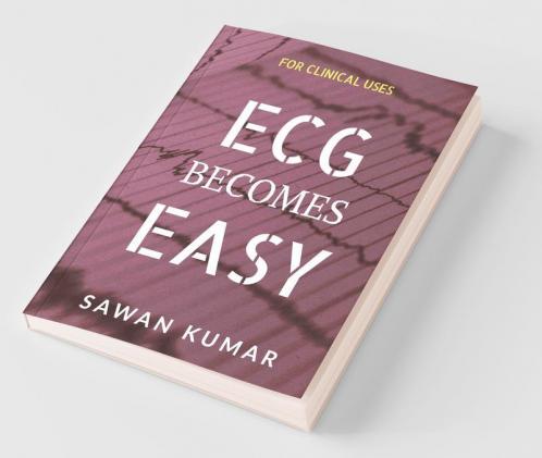 Ecg Becomes Easy