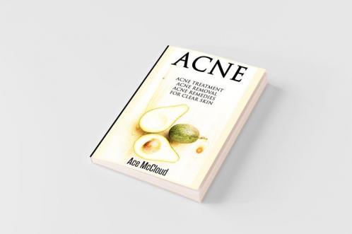 Acne