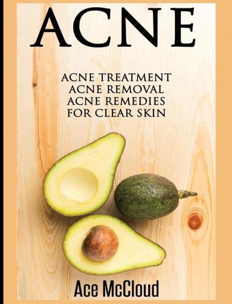 Acne: Acne Treatment: Acne Removal: Acne Remedies For Clear Skin (Acne Skin Care Treatments from Diet & Medical)