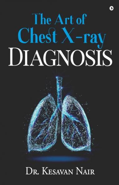 The Art Of Chest X-Ray Diagnosis