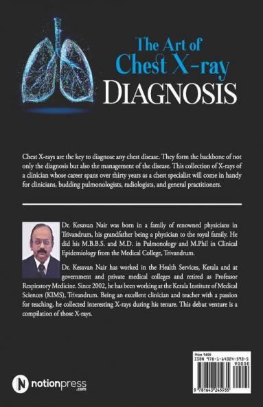 The Art Of Chest X-Ray Diagnosis