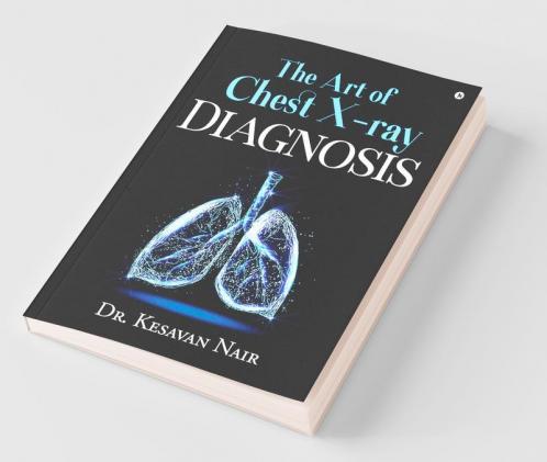 The Art Of Chest X-Ray Diagnosis