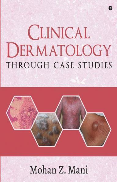 Clinical Dermatology Through Case Studies
