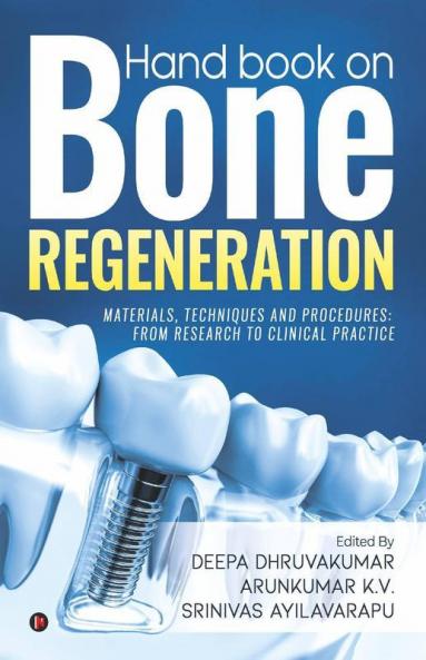 Hand book on Bone regeneration