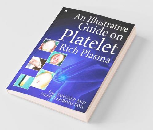 An Illustrative Guide On Platelet Rich Plasma