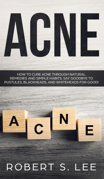 Acne: How to Cure Acne through Natural Remedies and Simple Habits. Say Goodbye to Pustules Blackheads and Whiteheads for Good!