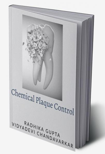 Chemical Plaque Control