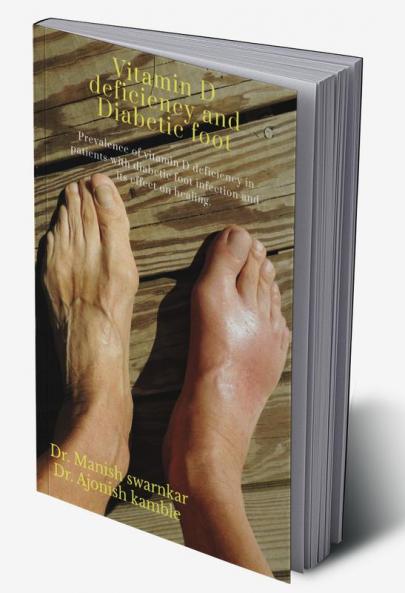 Prevalence of vitamin D deficiency in patients with diabetic foot infection and its effect on healing. : vitamin D deficiency in Diabetic foot infection