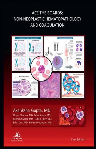 Ace The Boards: Non Neoplastic Hematopathology And Coagulation