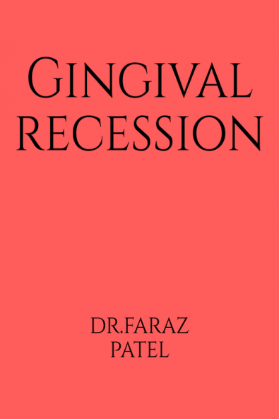 Gingival Recession