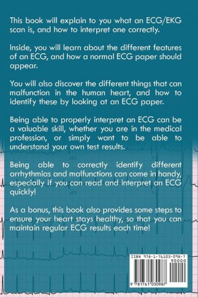 ECG & EKG Interpretation