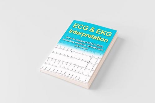 ECG & EKG Interpretation