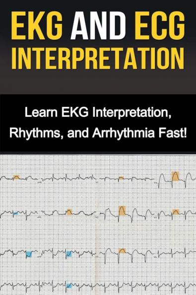 EKG and ECG Interpretation: Learn EKG Interpretation Rhythms and Arrhythmia Fast!