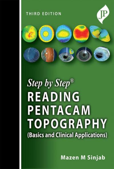 STEP BY STEP READING PENTACAM TOPOGRAPHY (BASICS AND CLINICAL APPLICATIONS)