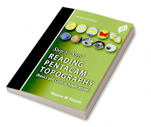 STEP BY STEP READING PENTACAM TOPOGRAPHY (BASICS AND CLINICAL APPLICATIONS)
