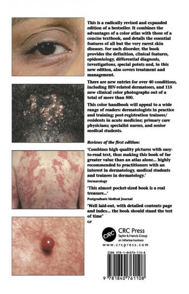 Dermatology