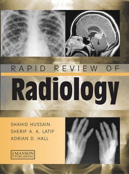 Rapid Review of Radiology
