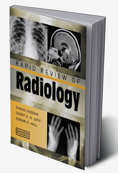 Rapid Review of Radiology