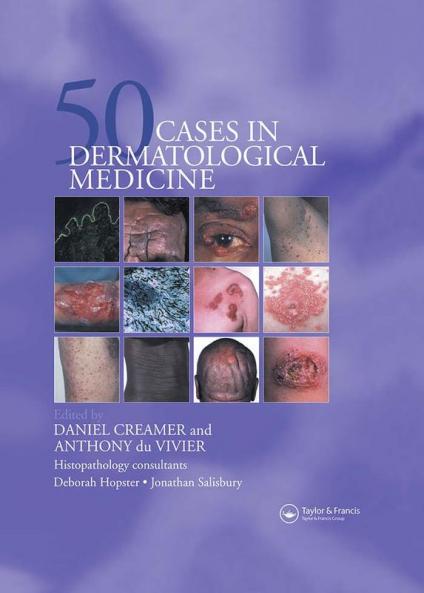 Fifty Dermatological Cases