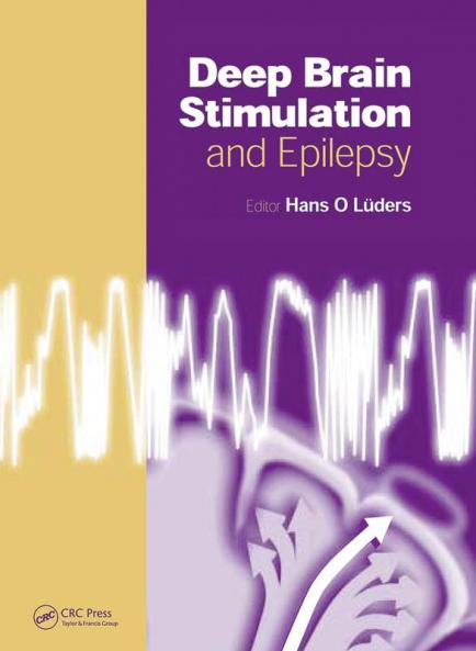 Deep Brain Stimulation and Epilepsy