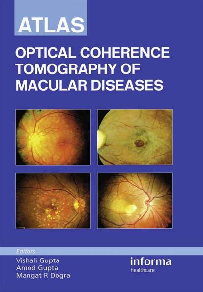 Atlas of Optical Coherence Tomography of Macular Diseases