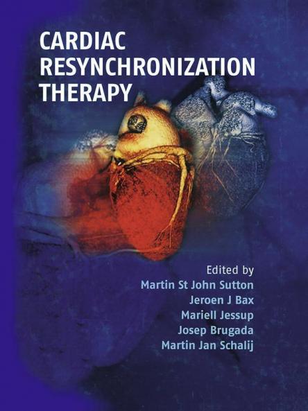 Cardiac Resynchronization Therapy