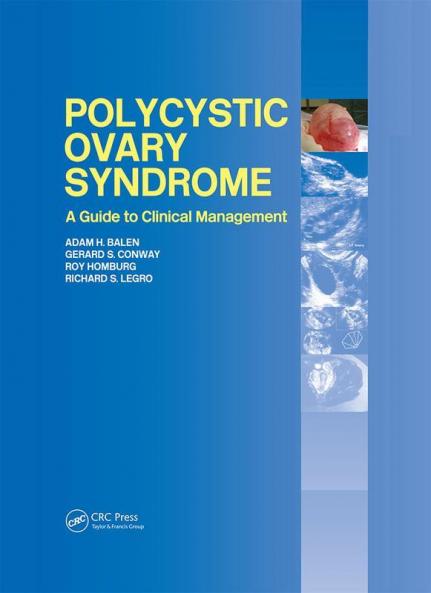 Polycystic Ovary Syndrome