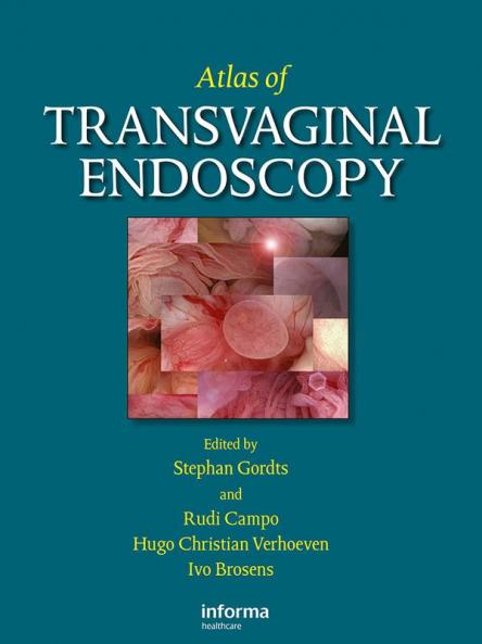 Atlas of Transvaginal Endoscopy