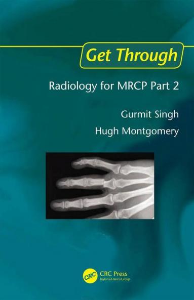 Get Through Radiology for MRCP Part 2