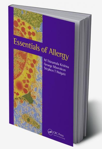 Essentials of Allergy