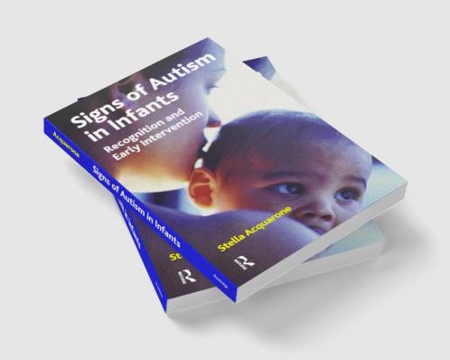 Signs of Autism in Infants