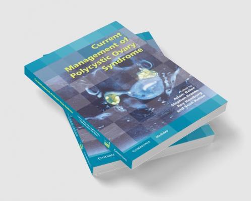 Current Management of Polycystic Ovary Syndrome
