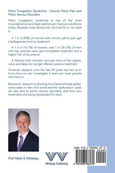 Pelvic Congestion Syndrome - Chronic Pelvic Pain and Pelvic Venous Disorders