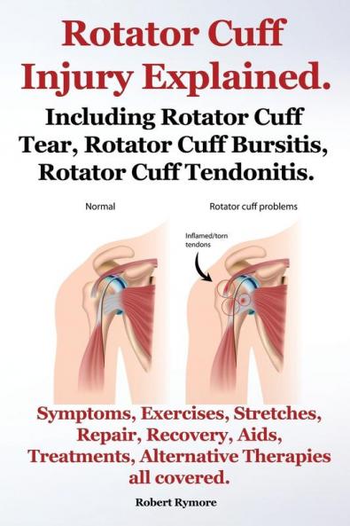 Rotator Cuff Injury Explained. Including Rotator Cuff Tear Rotator Cuff Bursitis Rotator Cuff Tendonitis. Symptoms Exercises Stretches Repair ... Alternative Therapies all covered.