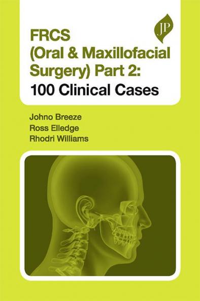 FRCS (ORAL & MAXILLOFACIAL SURGERY) PART 2: 100 CLINICAL CASES