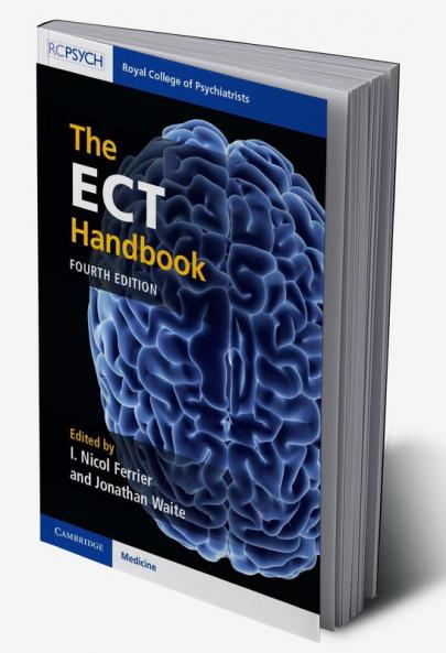 The ECT Handbook